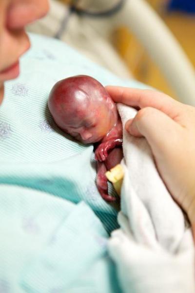 Bambino di 19 settimane nato vivo
