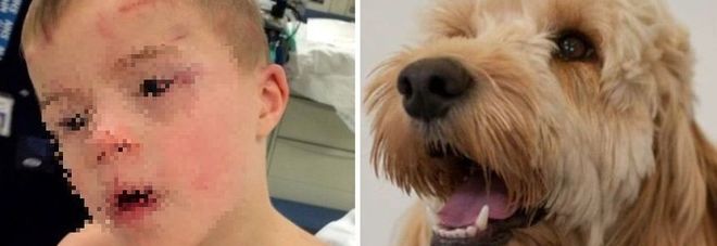 Bimbo down di 5 anni incastrato nell'asciugatrice, salvato dal suo cane