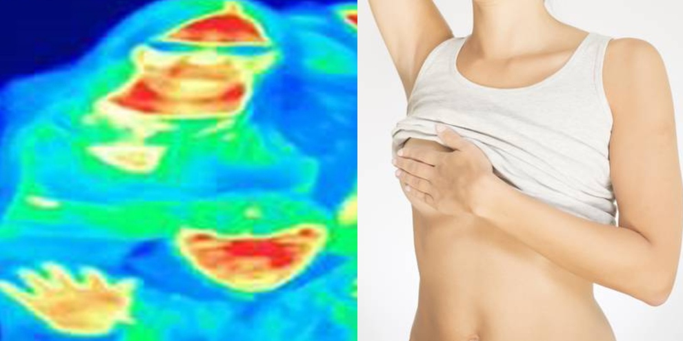 Scopre di avere un tumore al seno grazie a una fotocamera termica in un museo | Il Mattino