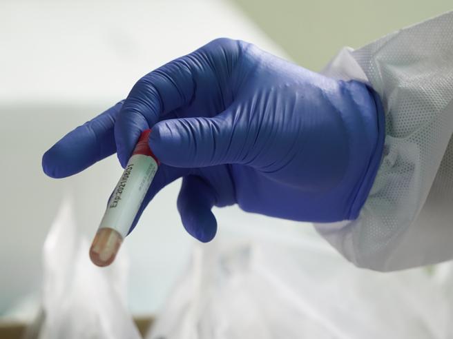 Coronavirus, i test degli anticorpi possono dirci se siamo immunizzati?-Corriere della sera➟